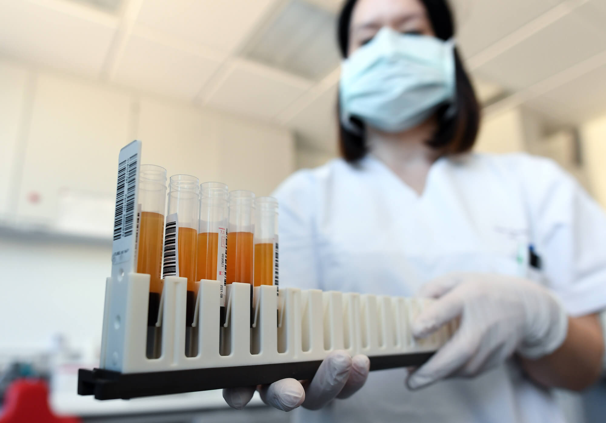 Өткен тәулікте коронавирус инфекциясын жұқтырған 13 874 жағдай тіркелді