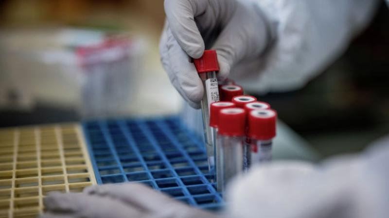 Өткен тәулікте 3231 адамнан коронавирус анықталды