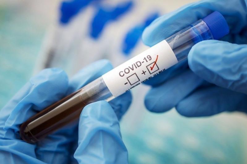 Өткен тәулікте 847 адамнан коронавирус анықталды