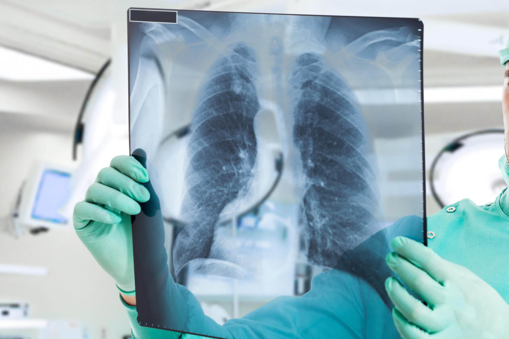 16 адам ауруынан айығып шықты