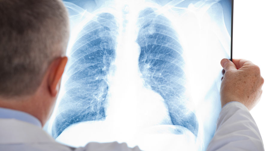 Тоғыз азамат коронавирус пневмониясын жұқтырған