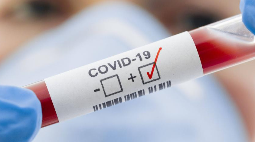 Бір тәулік ішінде 11 адам коронавирус жұқтырды