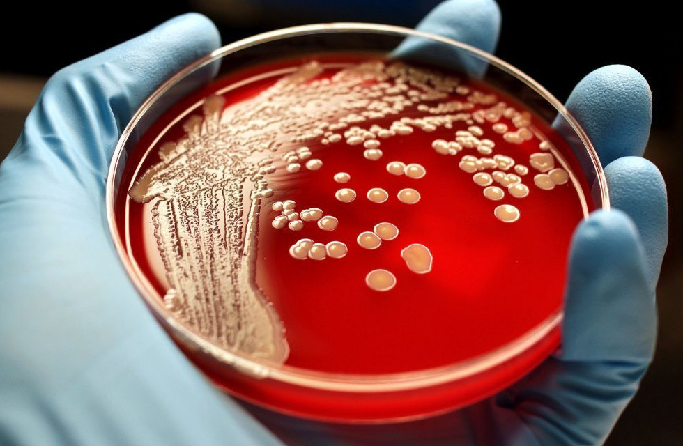 Түркістан облысының екі тұрғынында сібір жарасы анықталды