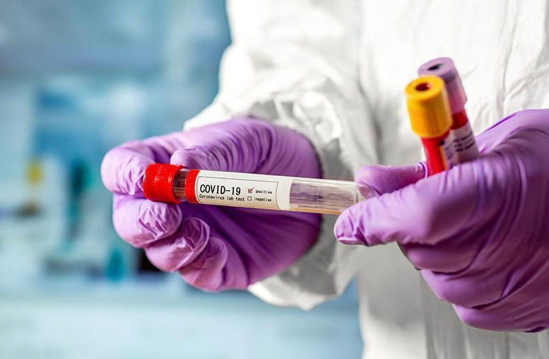 Өткен тәулікте 7 адамнан коронавирус анықталды