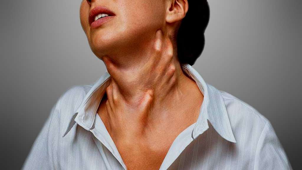 Тұқым қуалайтын ангионевротикалық ісіну қанша адамнан табылуы мүмкін?