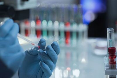 БҚО-да су қоймасынан тырысқақ бактериясы анықталды