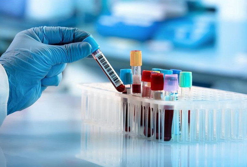 Өткен тәулікте 66 адам коронавирус жұқтырды