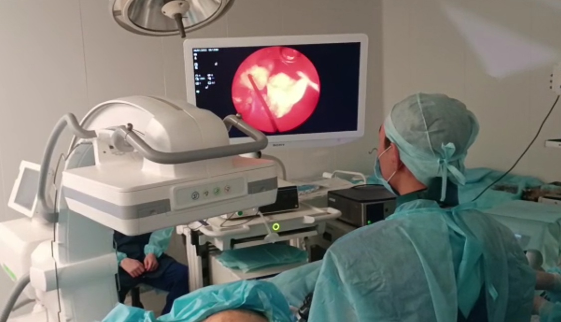 Бүйректегі тасты алудың жаңа тәсілі