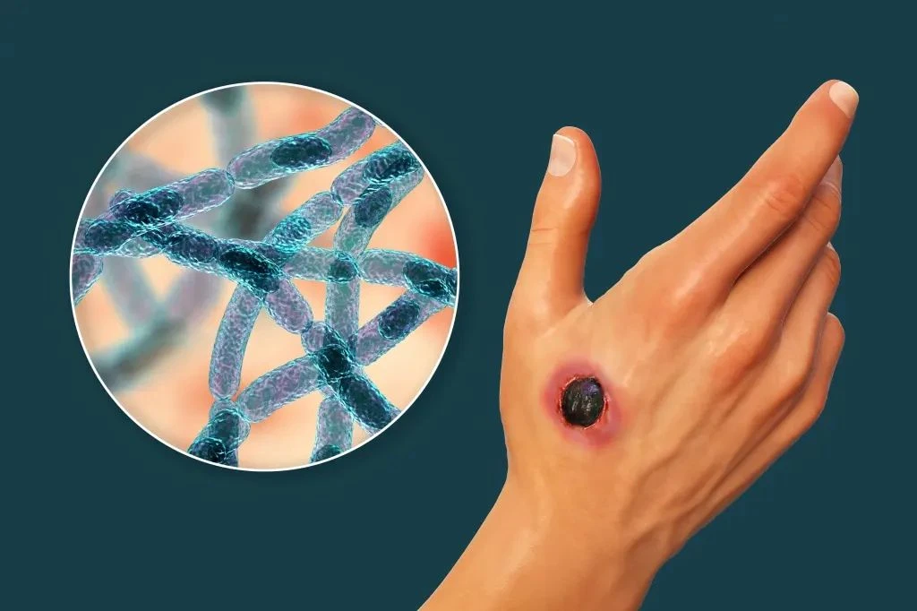 Топалаң шошытып тұр