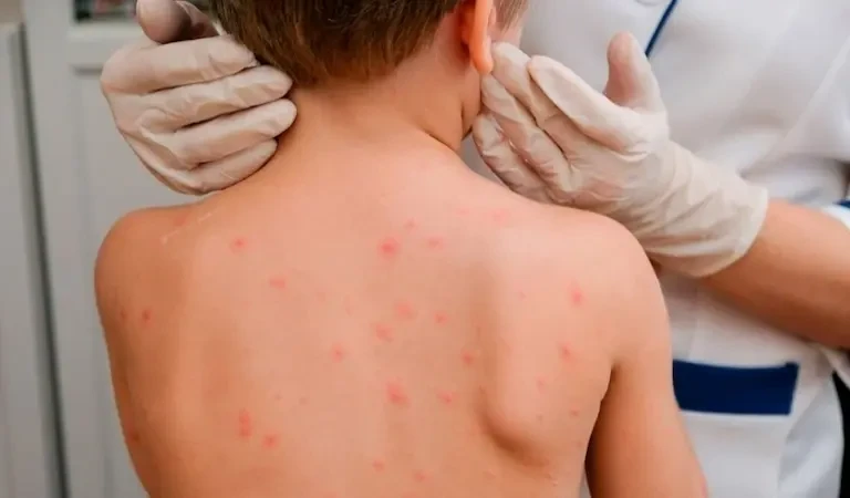 Қызылшаның емі қандай?