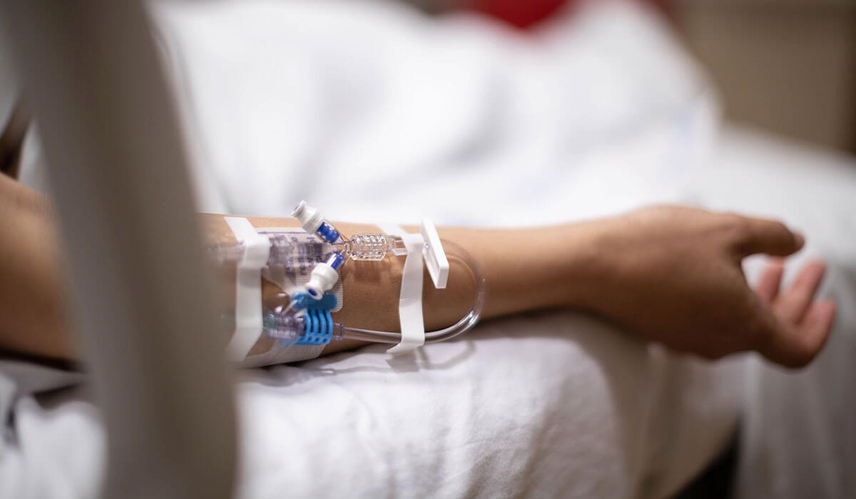 «Бір адам реанимацияда жатыр». Павлодарда алюминий зауытының 2 қызметкері күйіп қалды