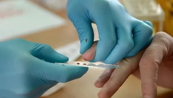 Атырауда мал базарының қызметкерінен сібір жарасы анықталды