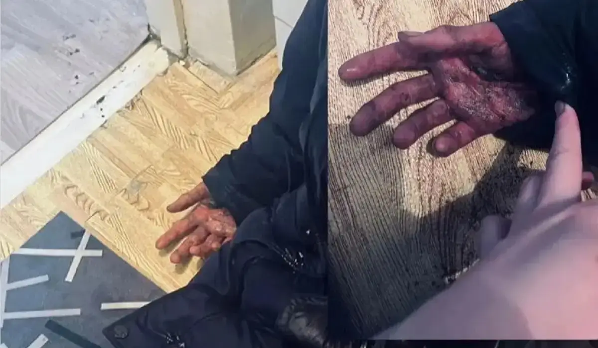 Қонаевта мектеп оқушысы антисептик ішіп қойған