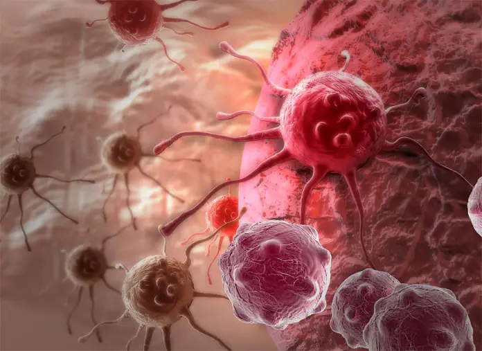 Атырау облысында 102 бала онкологиялық есепте тұр