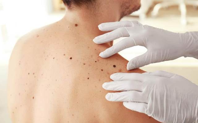 Адам папиллома вирусы қандай ауру