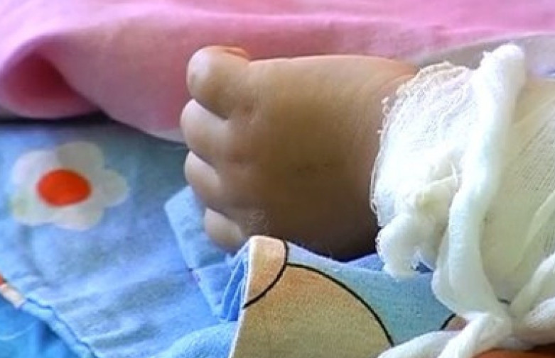 Қызылордадағы балабақшада бүлдіршін қайнаған суға күйіп қалды