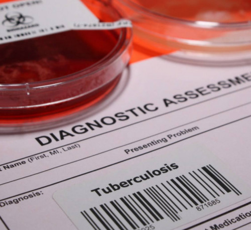 Туберкулез кезінде кох таяқшаларын 2 сағатта анықтауға болады