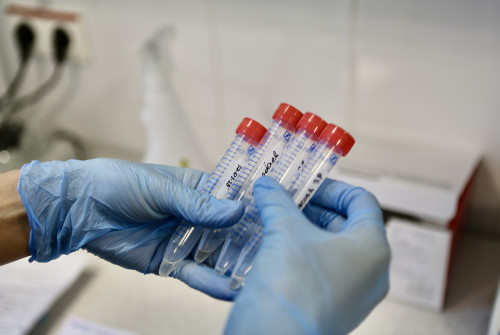 Инфекциялық ауруларға шалдығатындар көбейді. Себебі неде?