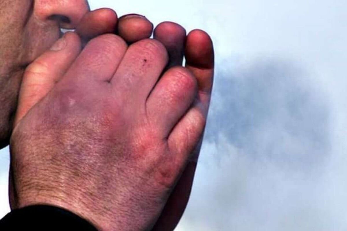 Қостанайда жыл басынан бері 20 адамды үсік шалған