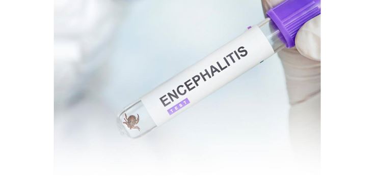 Кене энцефалитінен қалай қорғану керек?